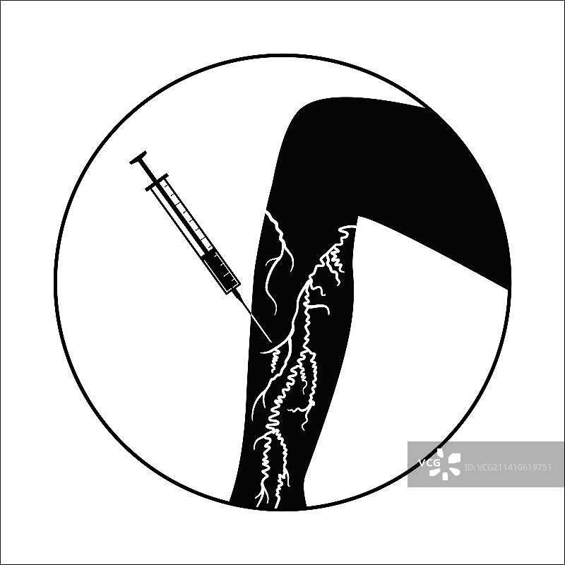 静脉曲张治疗图示图片素材