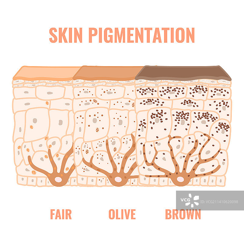 皮肤色素沉淀插图图片素材
