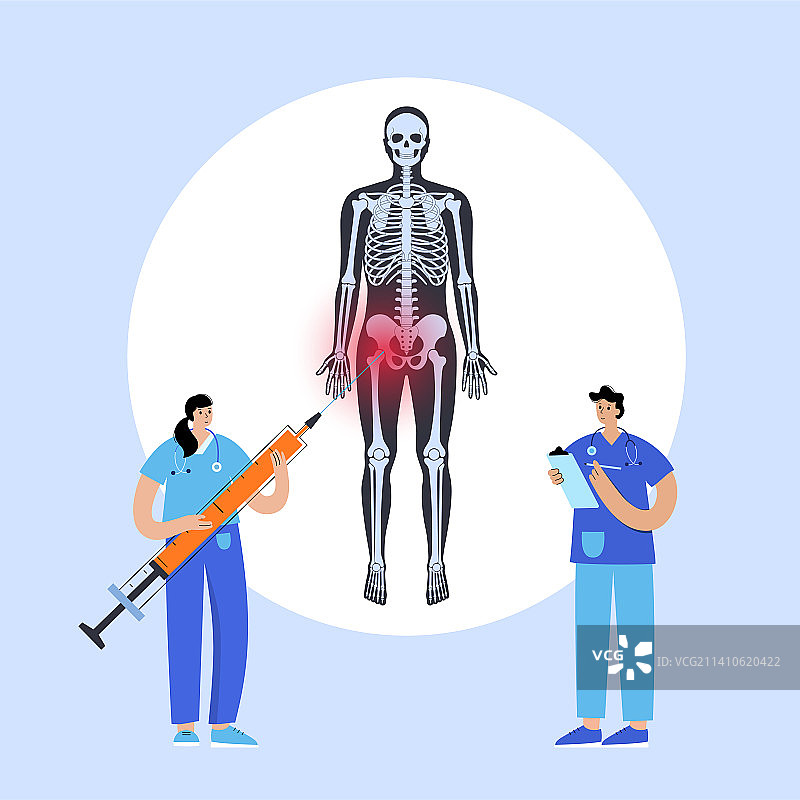 髋关节注射插图图片素材