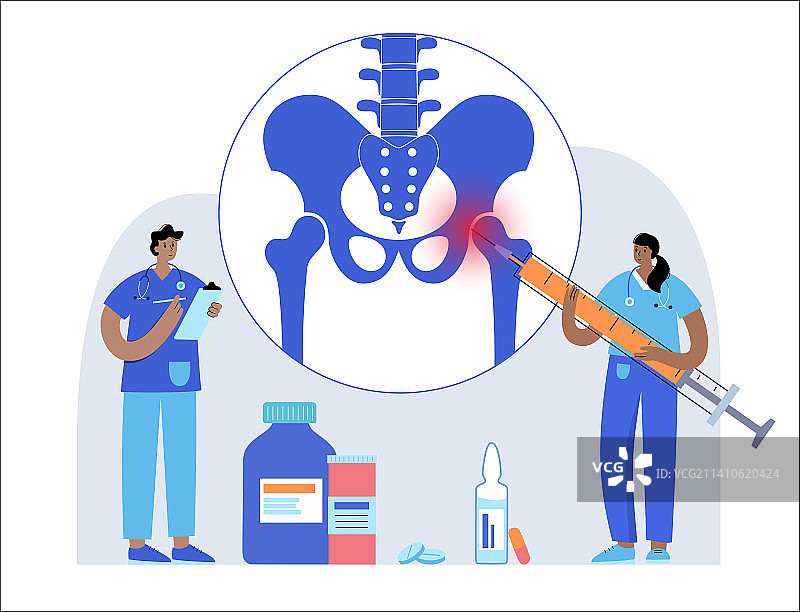 髋关节注射插图图片素材