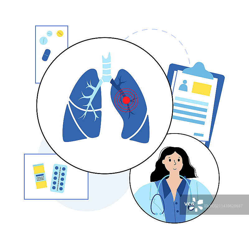 肺栓塞治疗图示图片素材