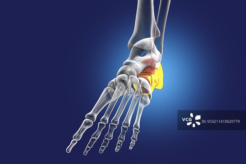 跟骨骨骼插画图片素材