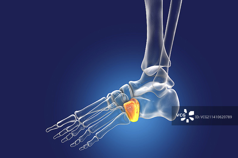 骰骨插图图片素材