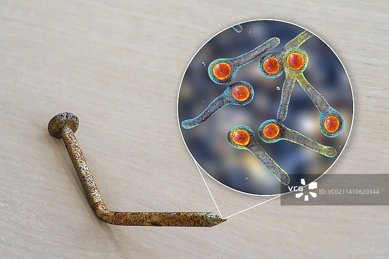 破伤风传播概念图图片素材