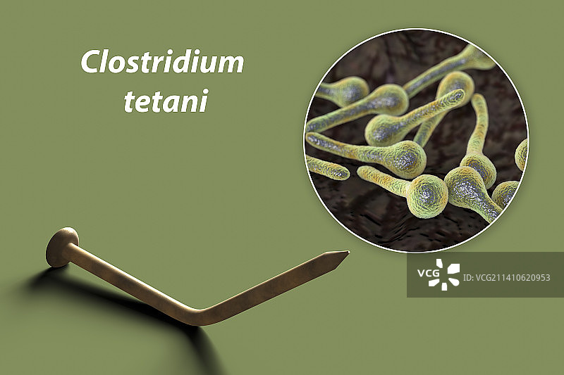 破伤风传播概念图图片素材
