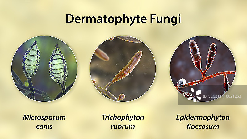 皮肤癣菌真菌，图示图片素材