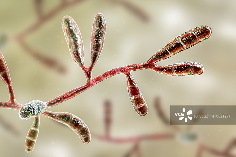 絮状表皮癣菌皮肤真菌，图示图片素材