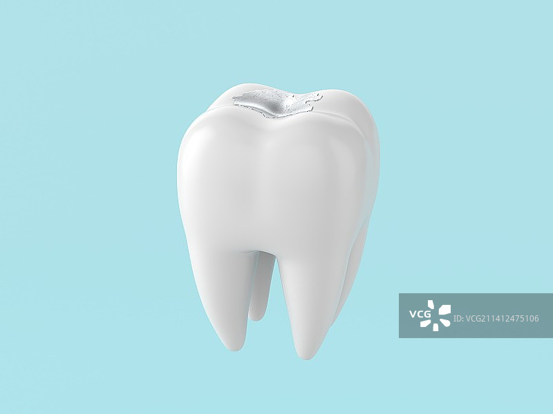 立体3d牙齿蛀牙模型图片素材