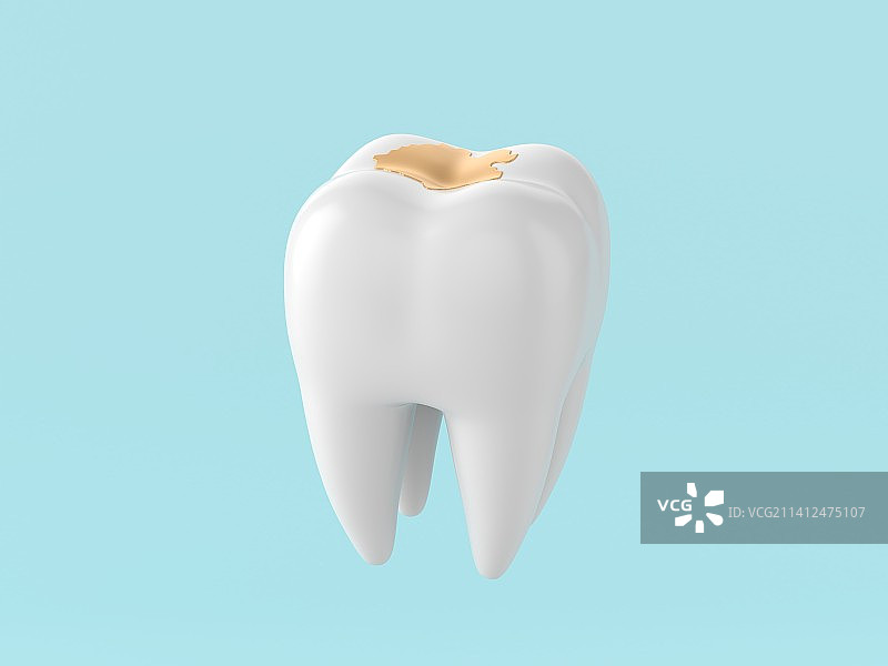 立体3d牙齿蛀牙模型图片素材