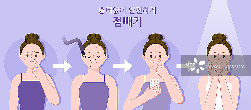 皮肤美容：激光点痣图片素材