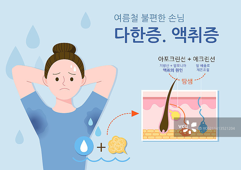 女性美容护肤：多汗症与体味护理图片素材