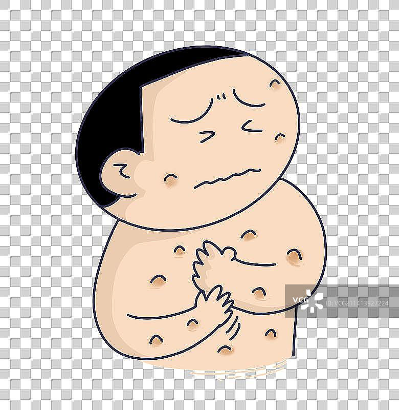 元素：荨麻疹图片素材