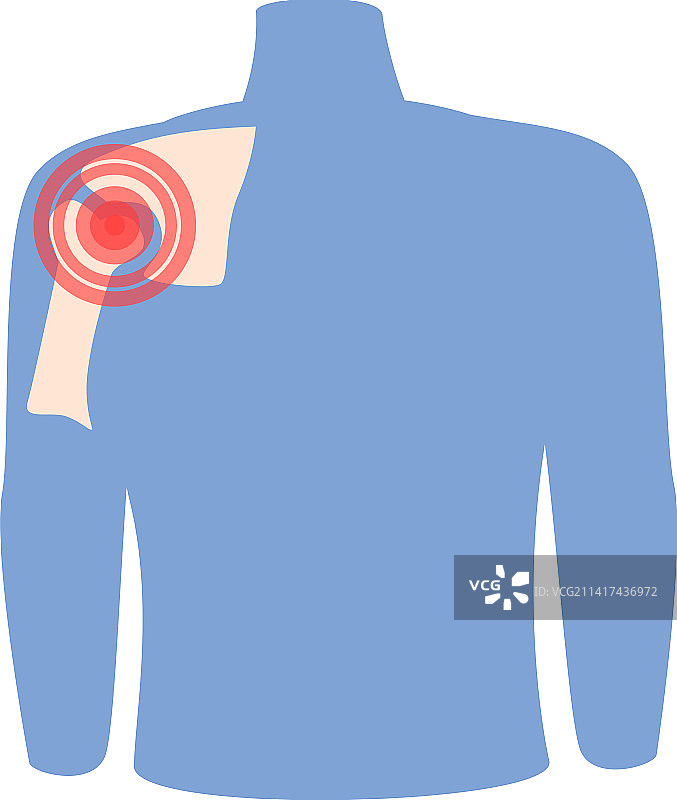 肩关节炎卡通关节疼痛图标图片素材