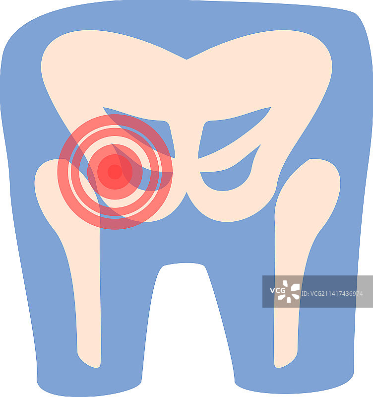 关节疼痛卡通医疗图标图片素材