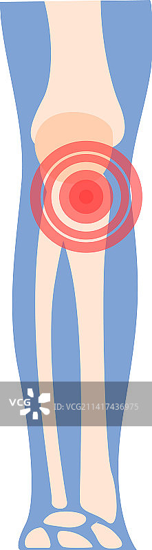 膝关节炎卡通图标关节疼痛图片素材