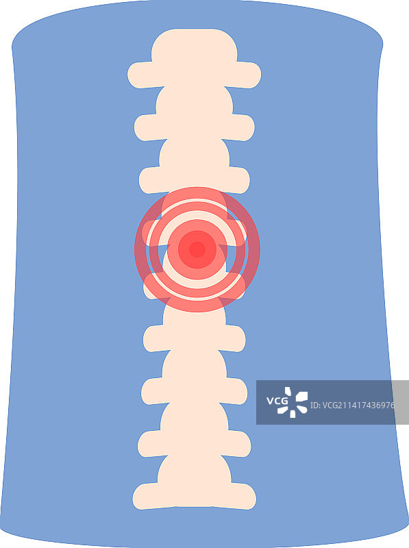 脊椎疼痛图标卡通关节炎图片素材