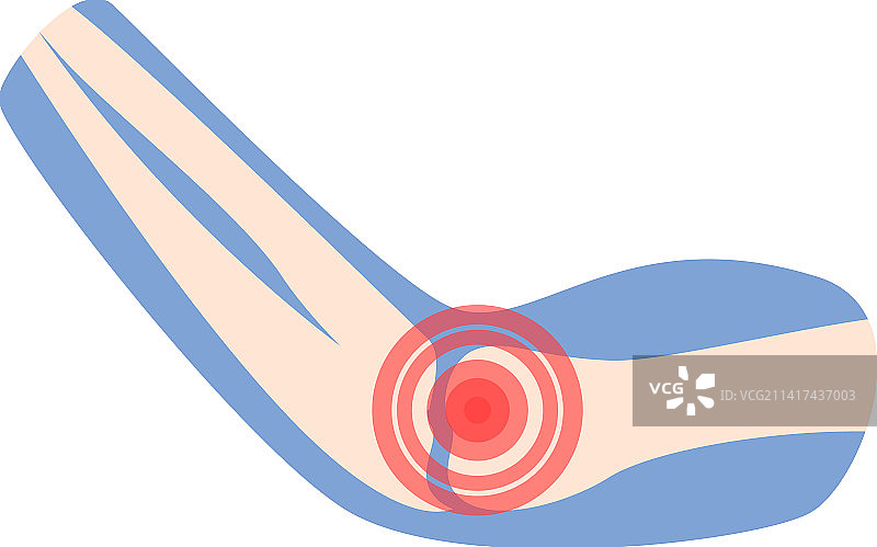 医疗治疗卡通关节疼痛图标图片素材