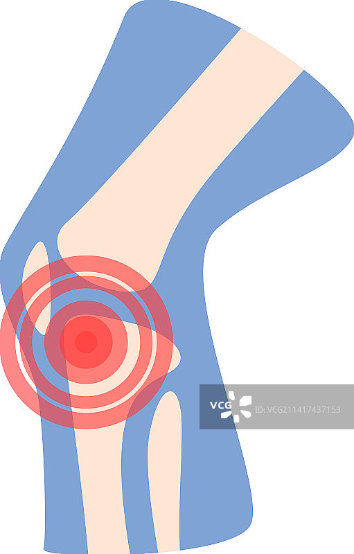 关节图标卡通关节炎图片素材