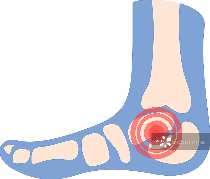 足部关节图标卡通医疗图片素材