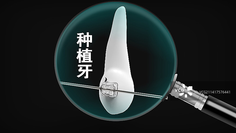 创意配图：种植牙图片素材