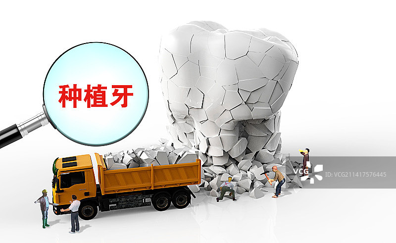 创意配图：种植牙图片素材
