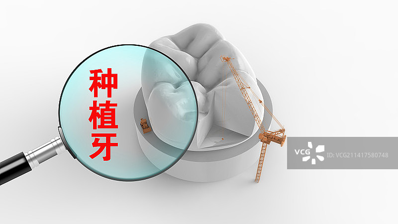 创意配图：种植牙图片素材