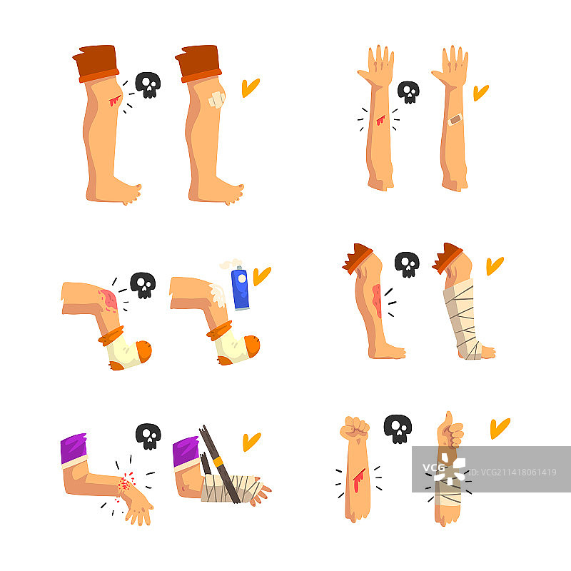 腿部和手臂受伤的急救图片素材