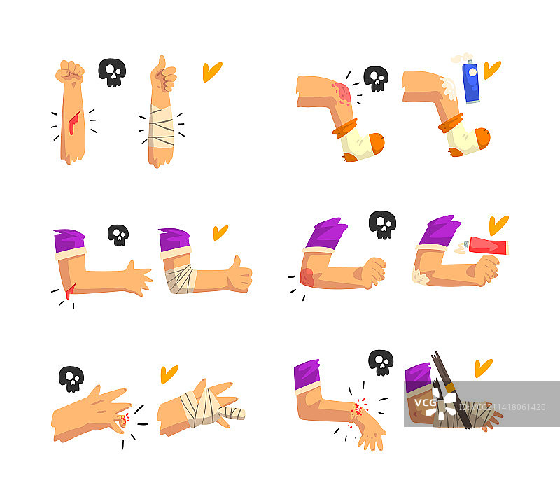 腿部和手臂受伤的急救图片素材