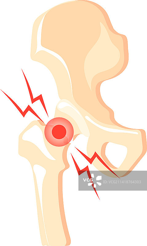 髋关节疼痛图标卡通骨骼酸痛图片素材