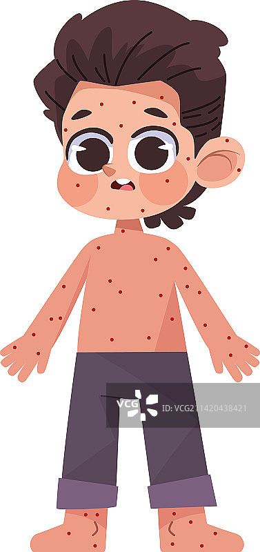 出水痘的小孩图片素材