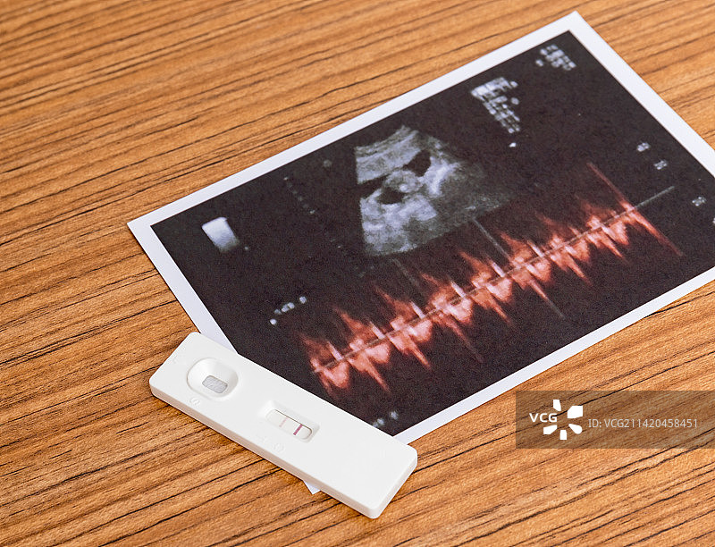 母婴概念验孕棒和一张胎儿B超照图片素材