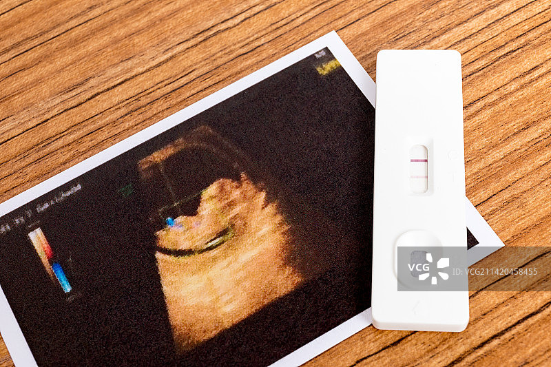 母婴概念验孕棒和一张胎儿B超照图片素材