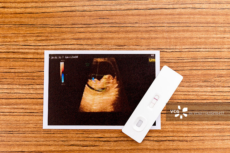 母婴概念验孕棒和一张胎儿B超照图片素材