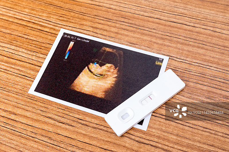 母婴概念验孕棒和一张胎儿B超照图片素材