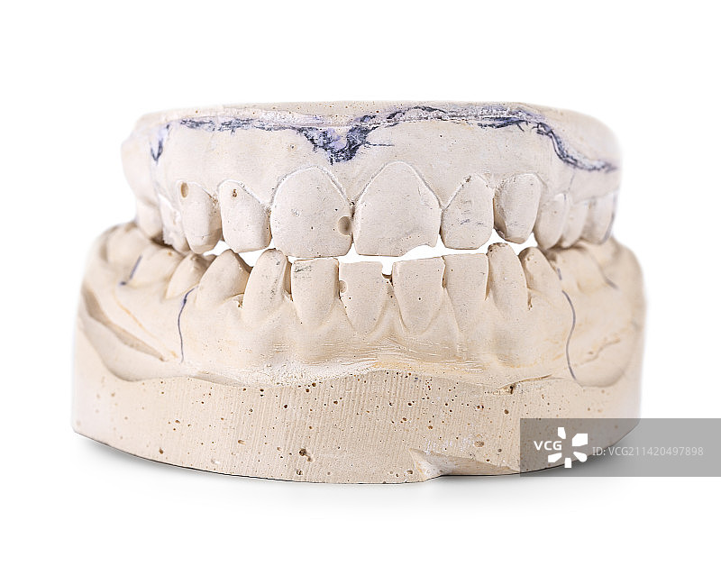 石膏牙齿颌骨模型图片素材