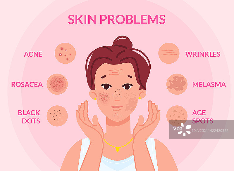 女性面部皮肤问题类型图片素材