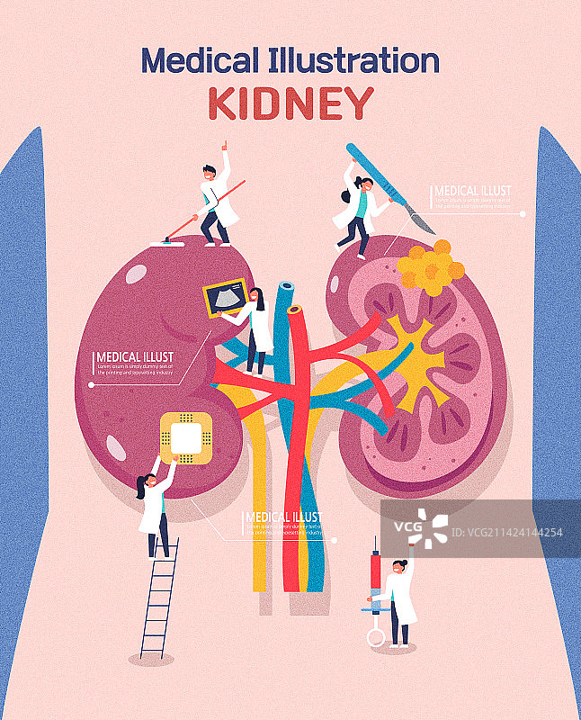 医疗：内脏器官、诊断、医生与肾结石图片素材