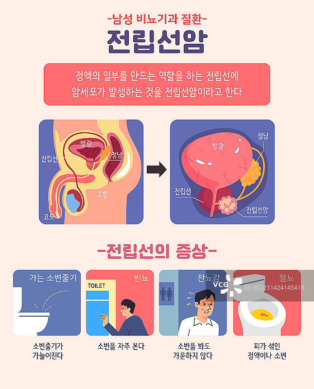 男人，泌尿系统，生殖泌尿系统，疾病，前列腺，前列腺癌图片素材