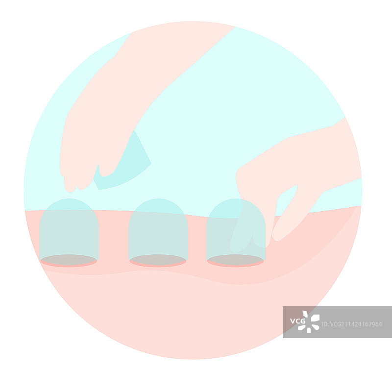 中医拔罐扁平插画图片素材