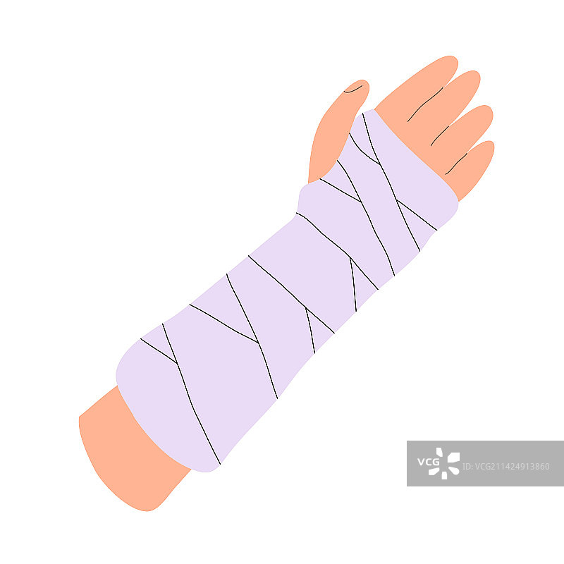 骨折手臂上的石膏绷带图片素材