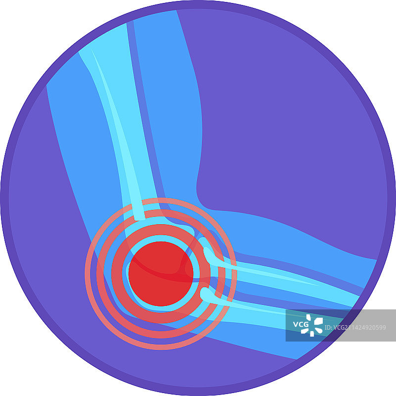 肘关节疼痛圆形医疗图标图片素材