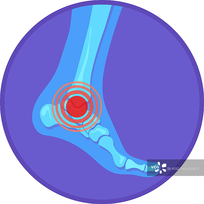 脚骨踝关节疼痛红色斑点图标图片素材
