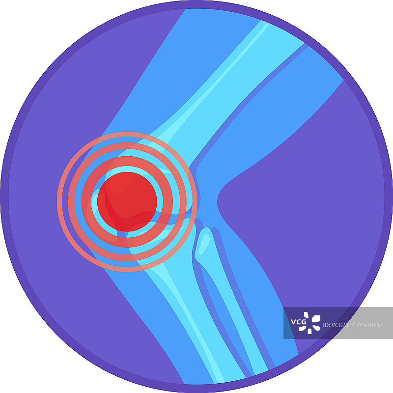 膝盖疼痛圆形图标，腿部关节符号图片素材