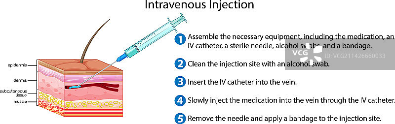 静脉注射讲解图片素材