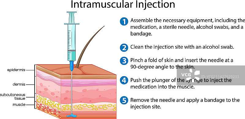 带说明的肌肉注射图片素材