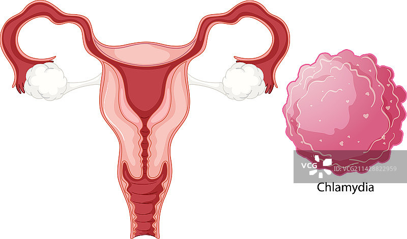 阴道感染细菌概念图片素材
