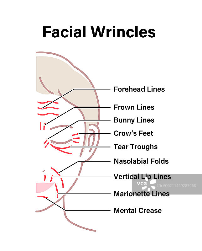 女性面部皱纹图片素材