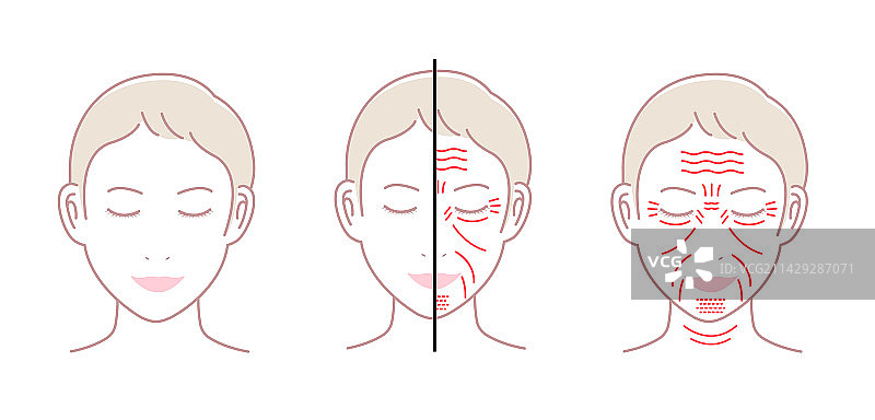 女性面部皱纹特写，无文字图片素材