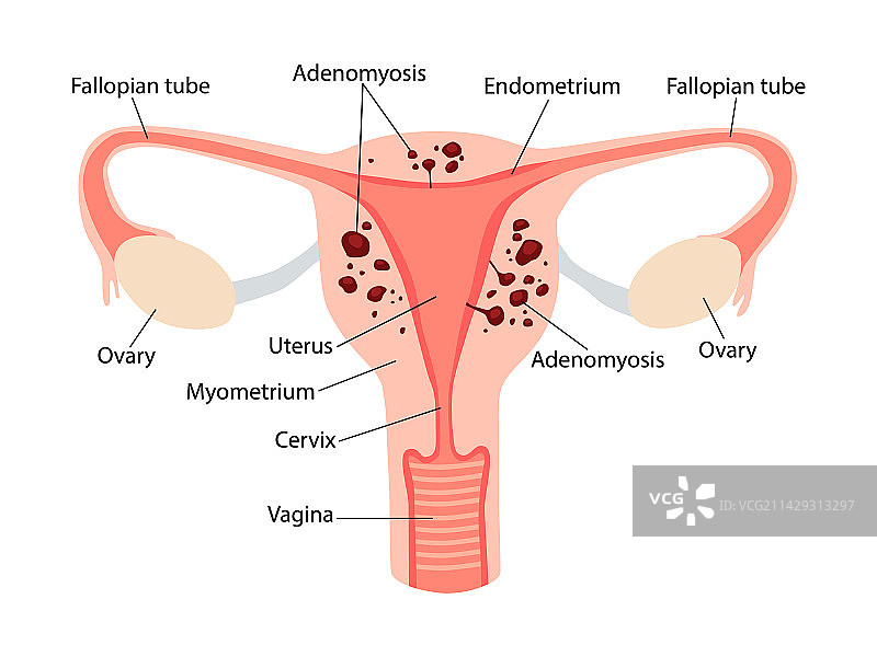 女性生殖系统解剖结构图片素材