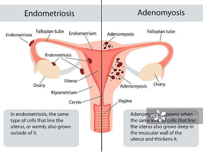 女性生殖系统解剖结构图片素材